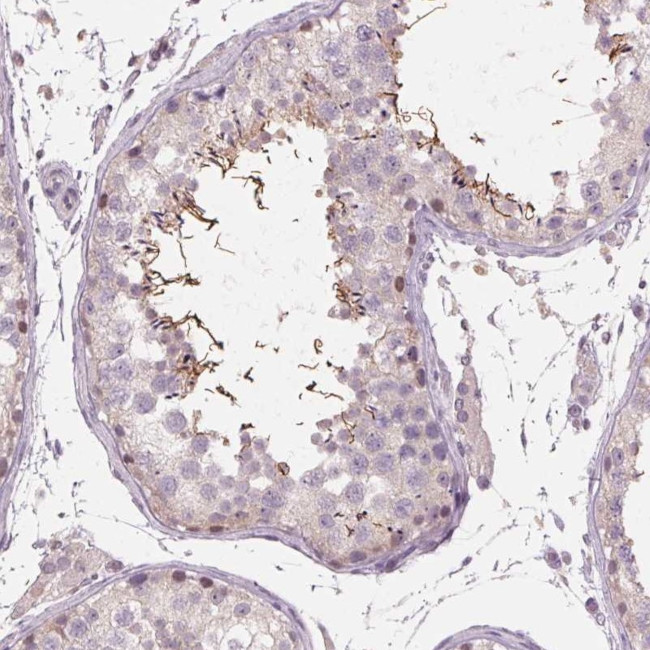 ADAM20 Antibody in Immunohistochemistry (IHC)