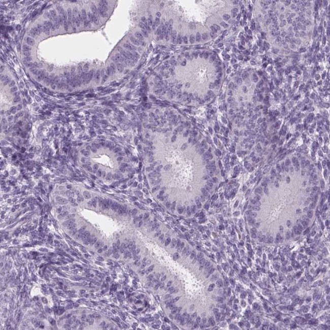 ADAM20 Antibody in Immunohistochemistry (IHC)