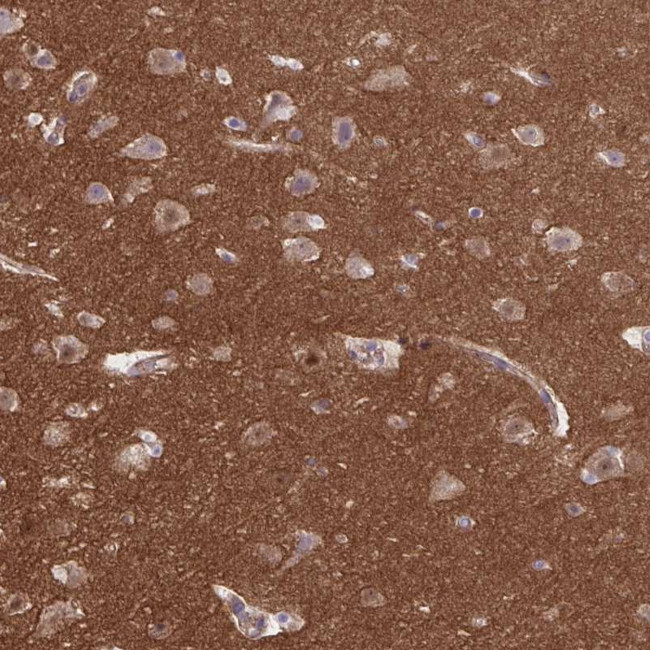 TTC7B Antibody in Immunohistochemistry (IHC)