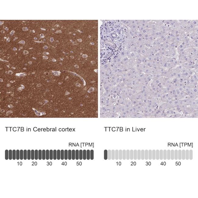 TTC7B Antibody