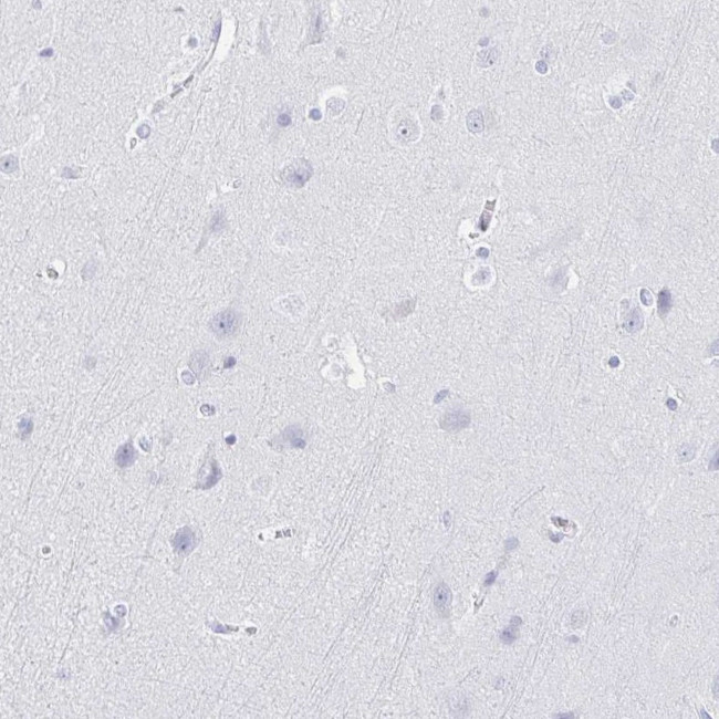 IYD Antibody in Immunohistochemistry (IHC)