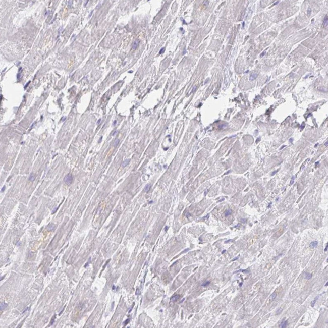 MYLK2 Antibody in Immunohistochemistry (IHC)