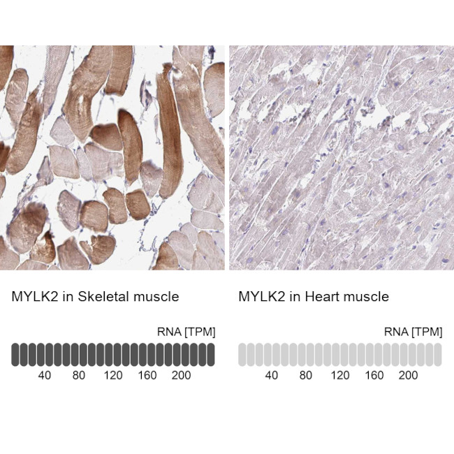 MYLK2 Antibody in Immunohistochemistry (IHC)