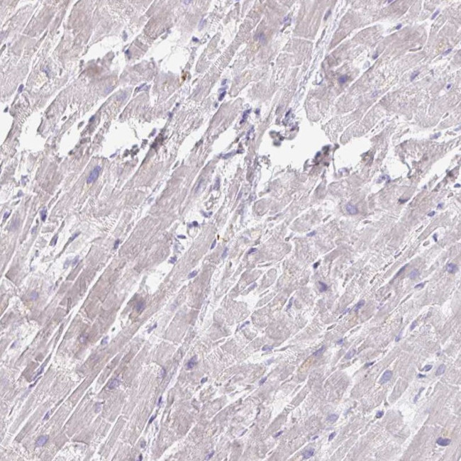 MYLK2 Antibody in Immunohistochemistry (IHC)