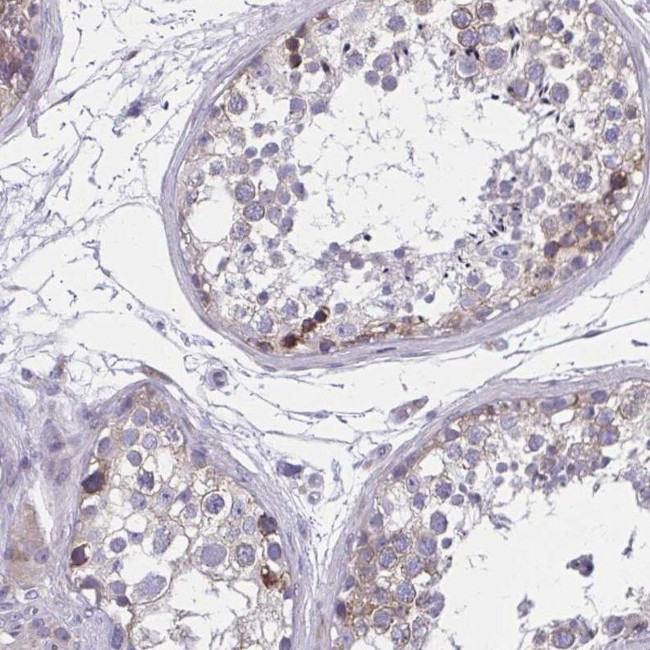 GIGYF2 Antibody in Immunohistochemistry (IHC)