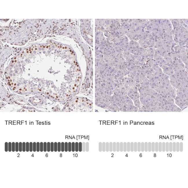 TREF1 Antibody in Immunohistochemistry (IHC)