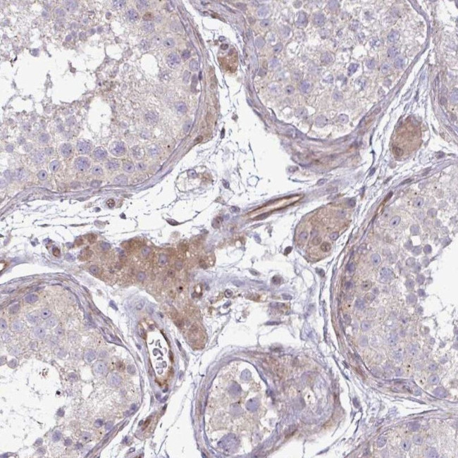 ZSCAN9 Antibody in Immunohistochemistry (IHC)