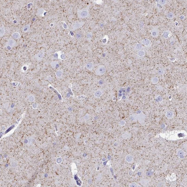 VGAT Antibody in Immunohistochemistry (IHC)