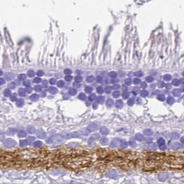 VGAT Antibody in Immunohistochemistry (IHC)