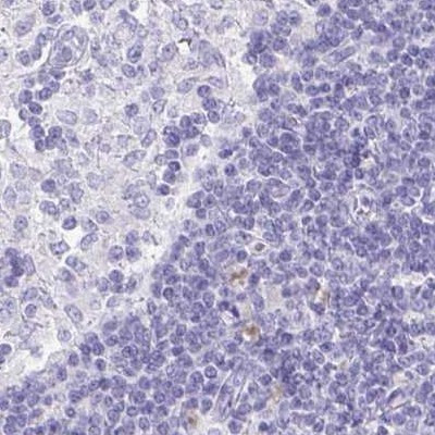 VGAT Antibody in Immunohistochemistry (IHC)