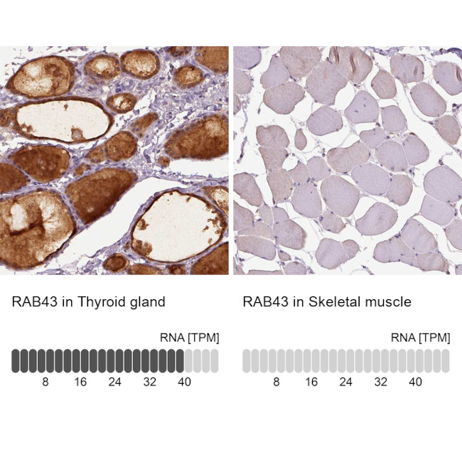 RAB43 Antibody in Immunohistochemistry (IHC)