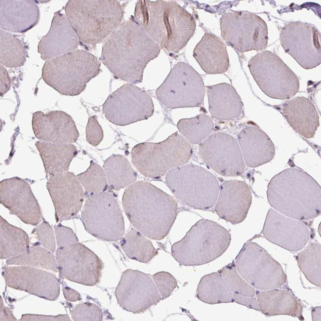 RAB43 Antibody in Immunohistochemistry (IHC)