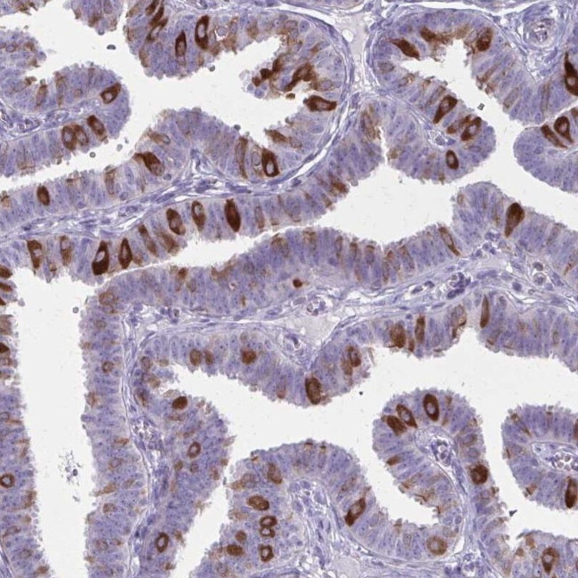 PITPNM1 Antibody in Immunohistochemistry (IHC)