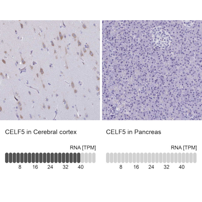 BRUNOL5 Antibody in Immunohistochemistry (IHC)