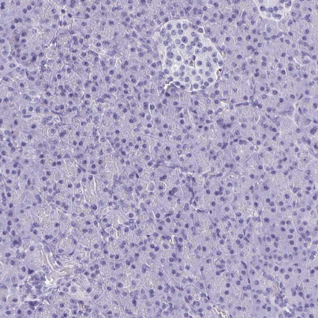 BRUNOL5 Antibody in Immunohistochemistry (IHC)