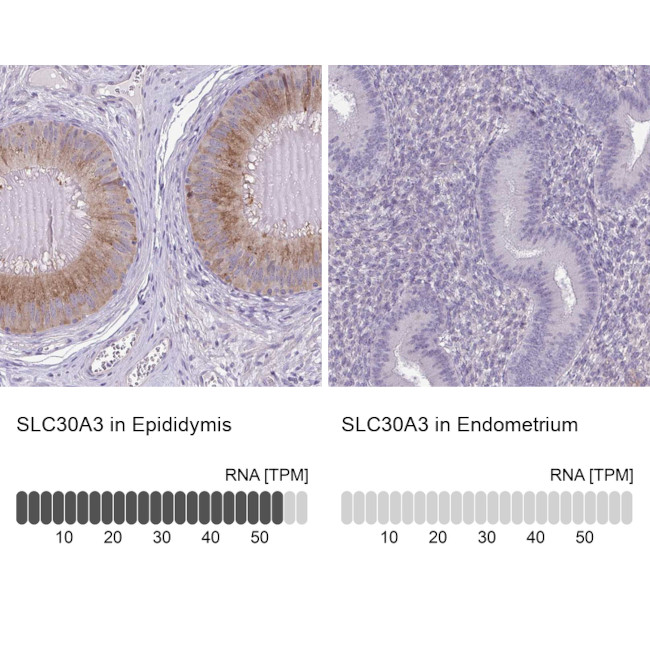 SLC30A3 Antibody in Immunohistochemistry (IHC)