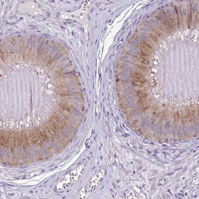 SLC30A3 Antibody in Immunohistochemistry (IHC)