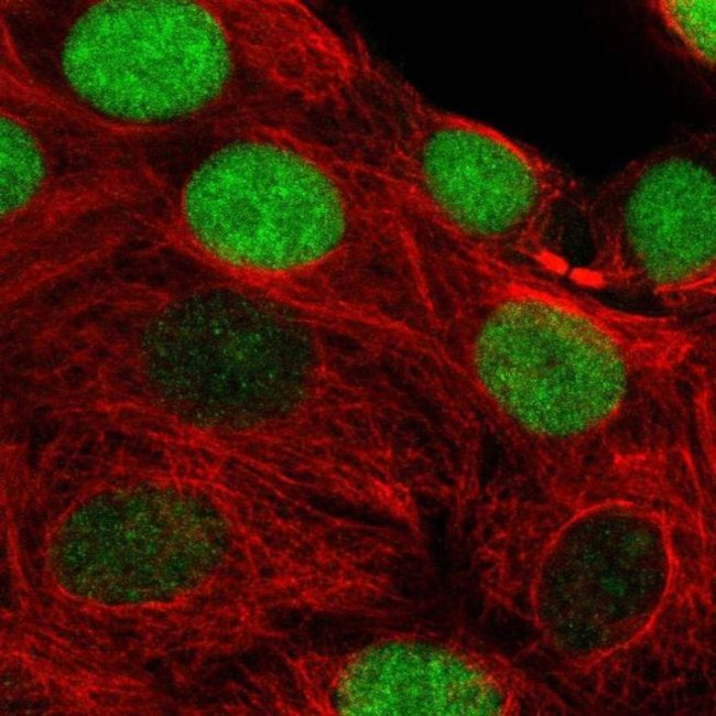 TIMELESS Antibody in Immunocytochemistry (ICC/IF)