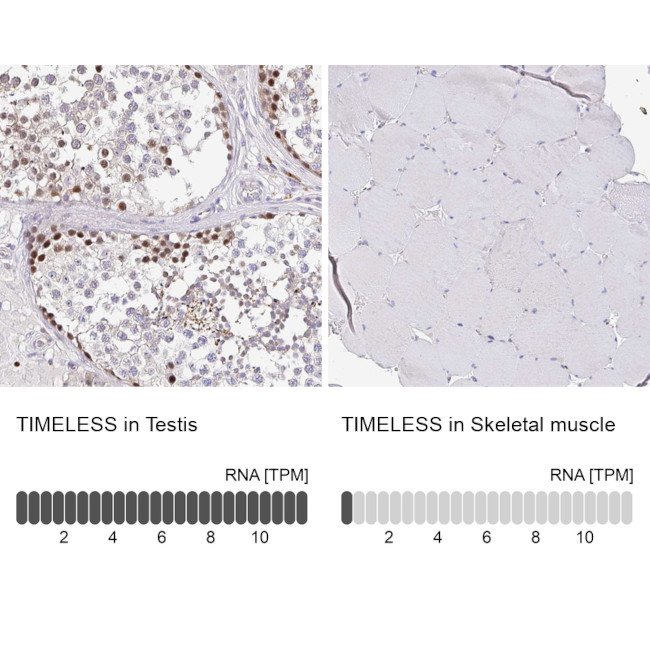 TIMELESS Antibody in Immunohistochemistry (IHC)