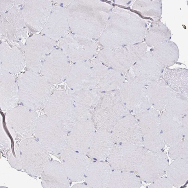 TIMELESS Antibody in Immunohistochemistry (IHC)