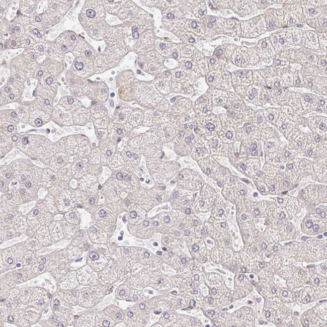 EHF Antibody in Immunohistochemistry (IHC)