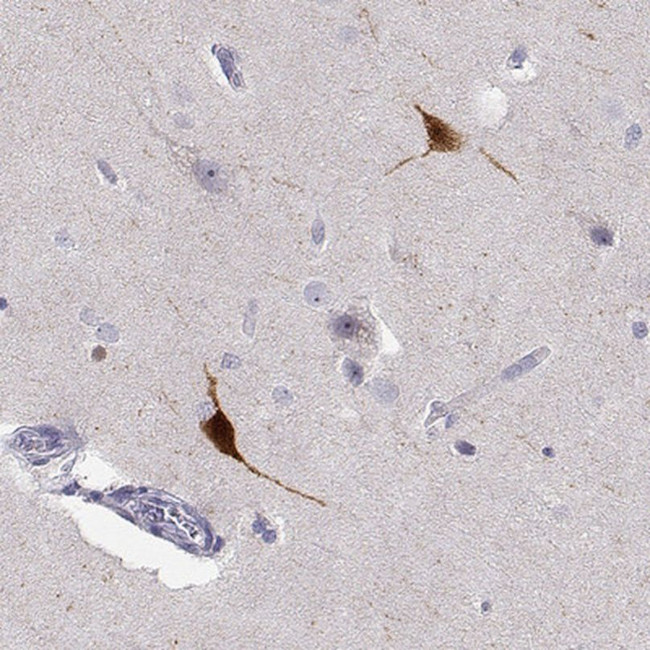 YJEFN3 Antibody in Immunohistochemistry (IHC)