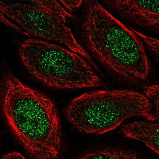 C19orf68 Antibody in Immunocytochemistry (ICC/IF)