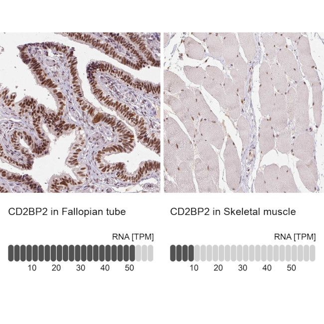 CD2BP2 Antibody in Immunohistochemistry (IHC)