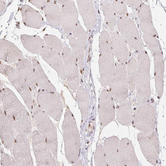 CD2BP2 Antibody in Immunohistochemistry (IHC)