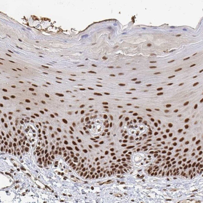 GTF3C6 Antibody in Immunohistochemistry (IHC)