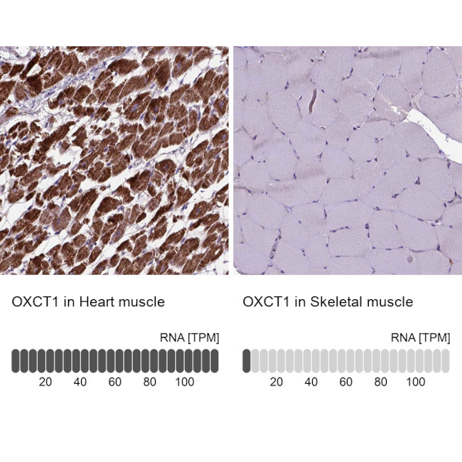 OXCT1 Antibody in Immunohistochemistry (IHC)