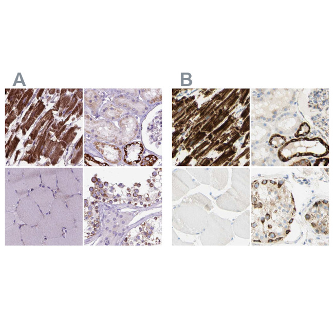 OXCT1 Antibody in Immunohistochemistry (IHC)