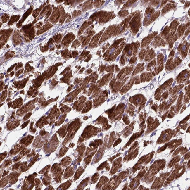 OXCT1 Antibody in Immunohistochemistry (IHC)