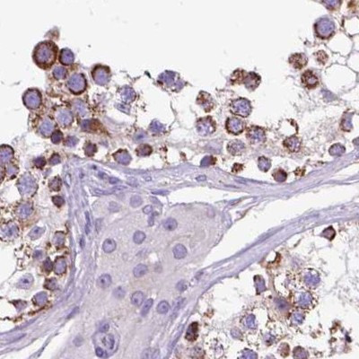 OXCT1 Antibody in Immunohistochemistry (IHC)