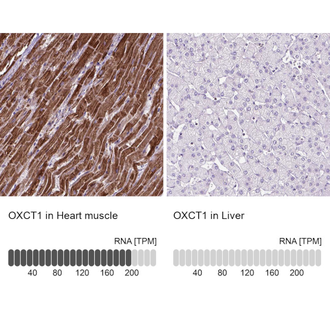 OXCT1 Antibody