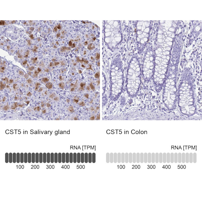 Cystatin D Antibody in Immunohistochemistry (IHC)