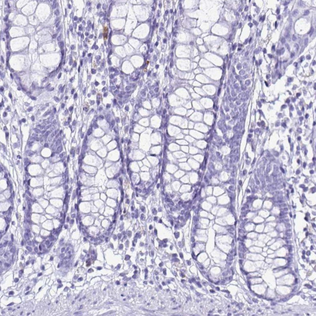 Cystatin D Antibody in Immunohistochemistry (IHC)