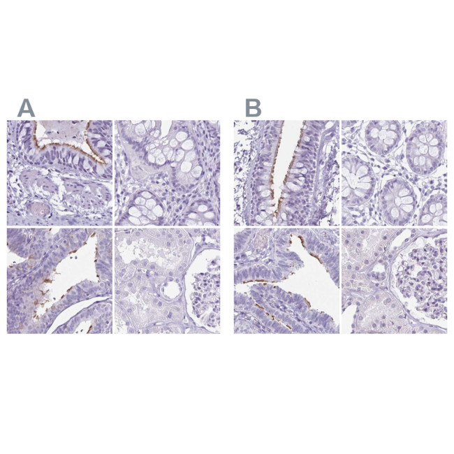 Enkurin Antibody in Immunohistochemistry (IHC)