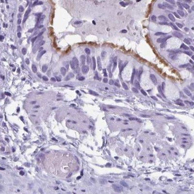 Enkurin Antibody in Immunohistochemistry (IHC)