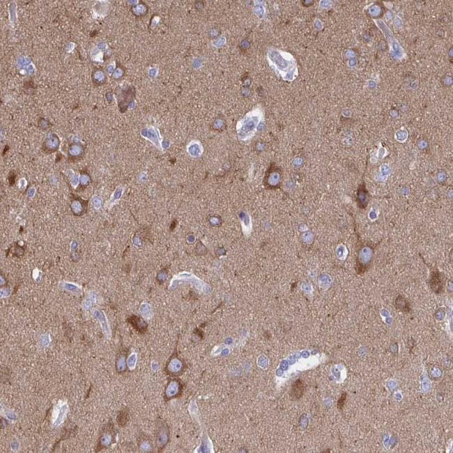 DYNC1I1 Antibody in Immunohistochemistry (IHC)