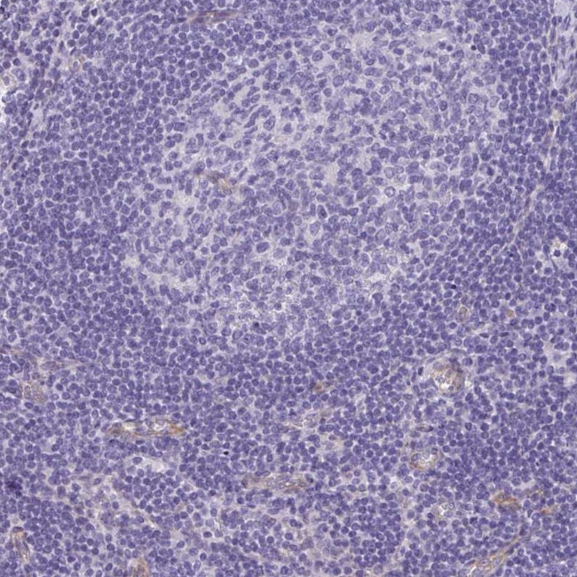 DYNC1I1 Antibody in Immunohistochemistry (IHC)