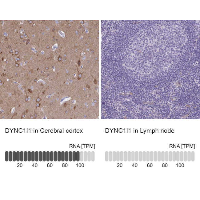 DYNC1I1 Antibody