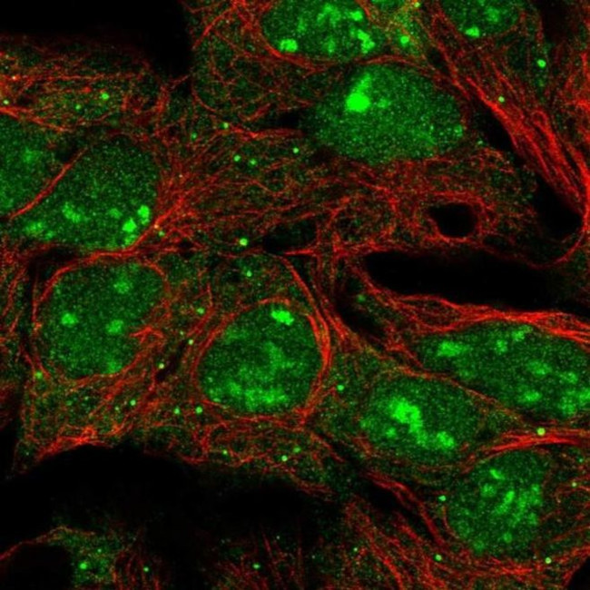 LIN28B Antibody in Immunocytochemistry (ICC/IF)