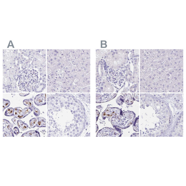 LIN28B Antibody in Immunohistochemistry (IHC)