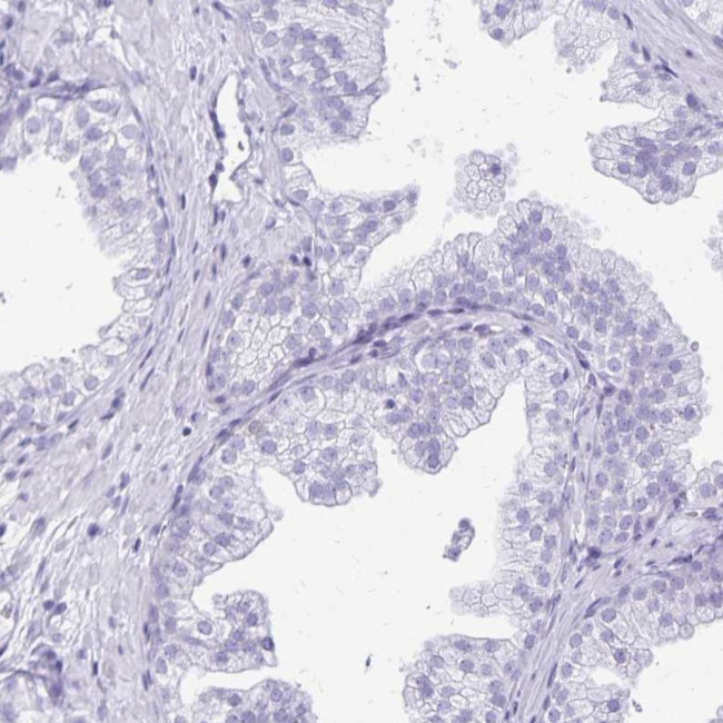 LIN28B Antibody in Immunohistochemistry (IHC)