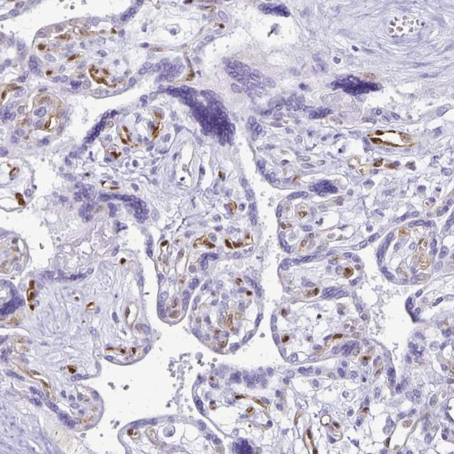 LIN28B Antibody in Immunohistochemistry (IHC)