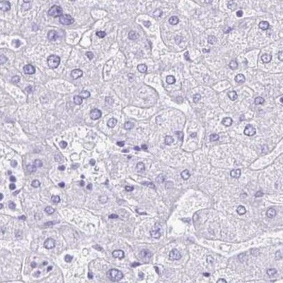 LIN28B Antibody in Immunohistochemistry (IHC)