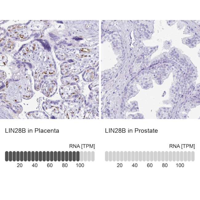 LIN28B Antibody