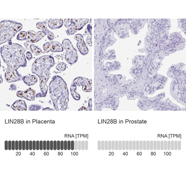 LIN28B Antibody