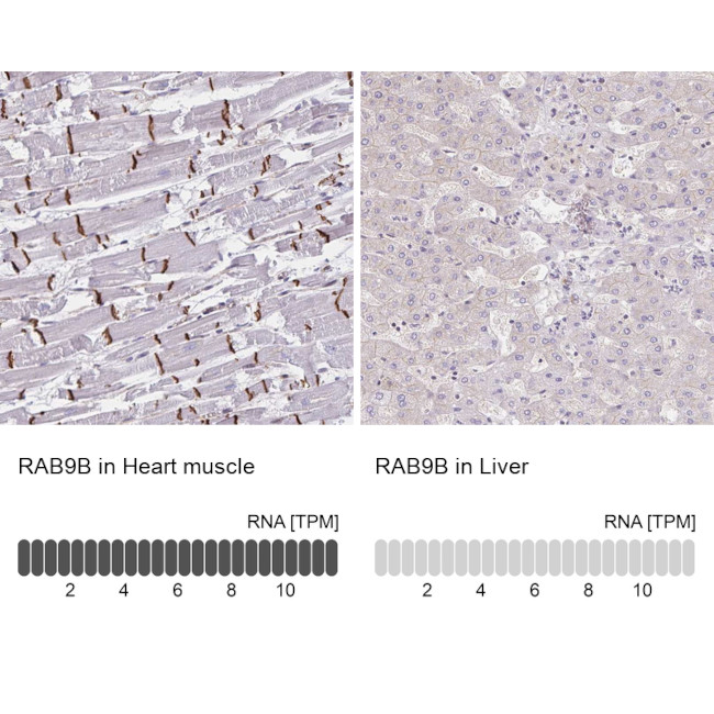 RAB9B Antibody in Immunohistochemistry (IHC)